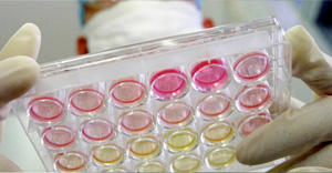 Indagini diagnostiche