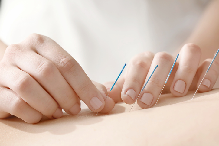Agopuntura e fertilità